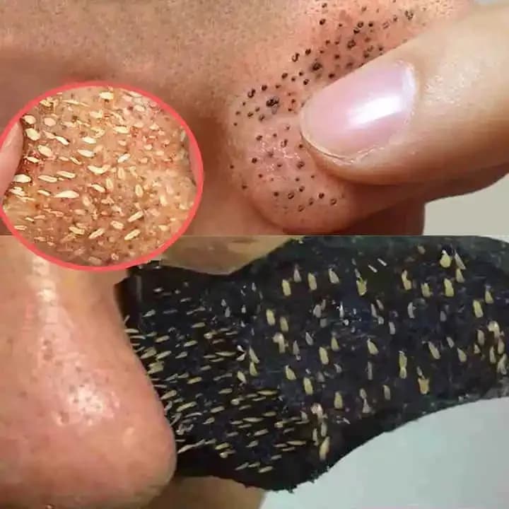 Natural Bamboo Charcoal Blackhead Remover Mask Peeling Off Nose Mask Face Cleaning Pore Strips